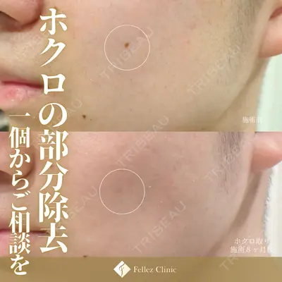 Fellez Clinic【フェルズクリニック】の症例