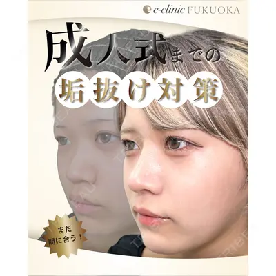 eクリニック 福岡院 伊藤 渉医師の症例