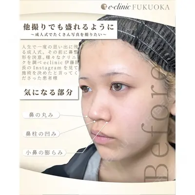 eクリニック 福岡院 伊藤 渉医師の症例