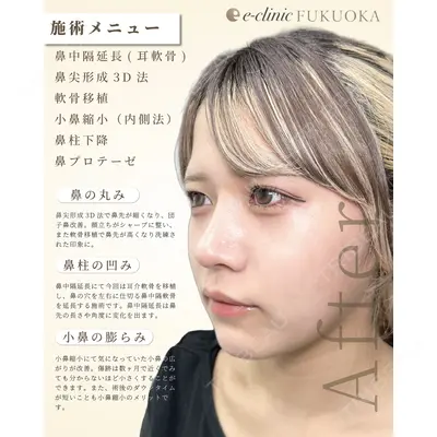 eクリニック 福岡院 伊藤 渉医師の症例