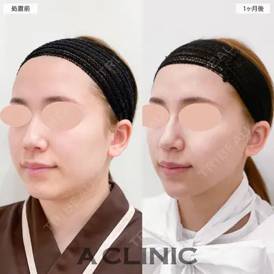 A CLINIC（エークリニック） 大阪院 田窪 賢志郎医師の症例