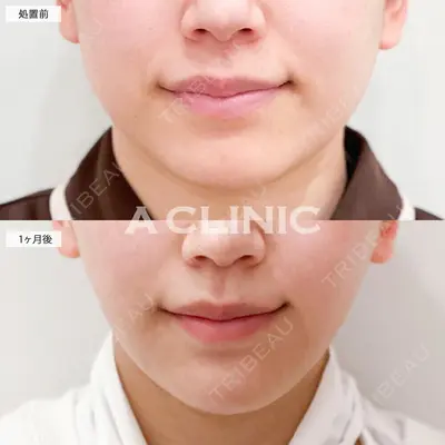 A CLINIC（エークリニック） 大阪院 田窪 賢志郎医師の症例