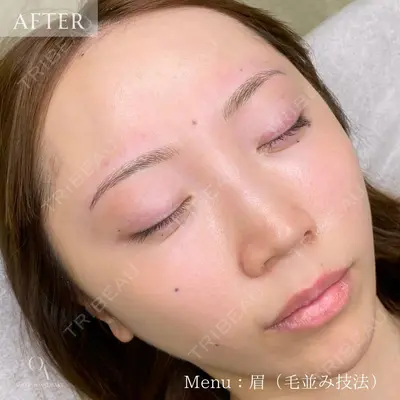 muni skin clinicの症例