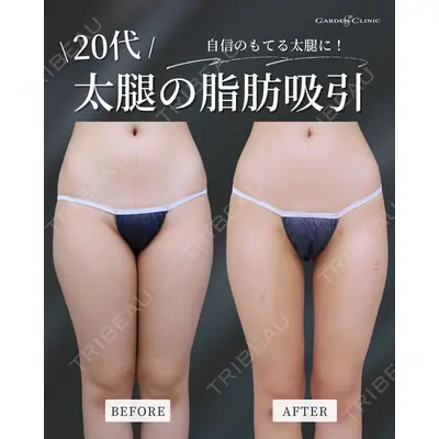 ガーデンクリニック 福岡院 安立 弘太医師の症例