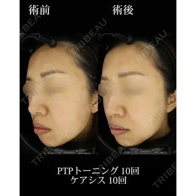 HAAB BEAUTY CLINIC 名古屋院の症例