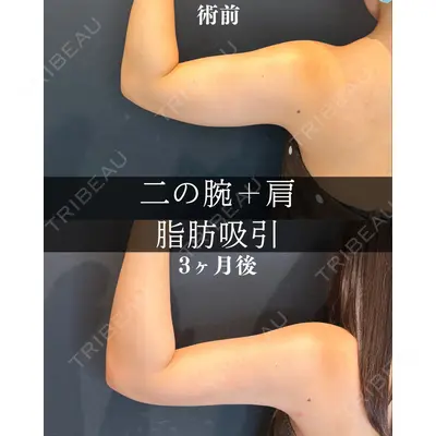 渋谷あおぞらクリニック美容外科・美容皮膚科 川口 理夏医師の症例