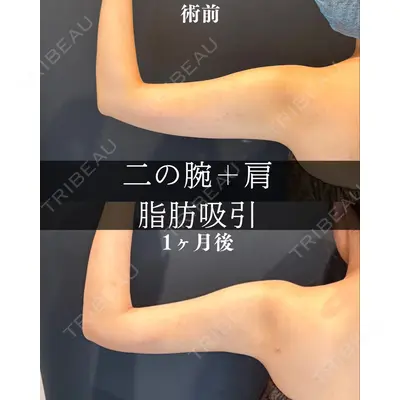 渋谷あおぞらクリニック美容外科・美容皮膚科 川口 理夏医師の症例
