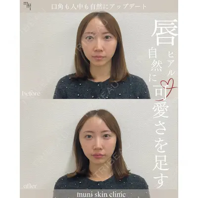 muni skin clinic 高麗 惠理医師の症例