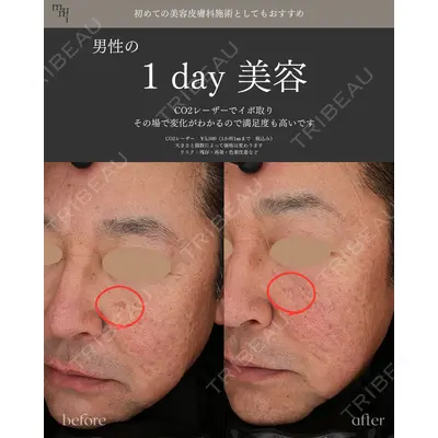 muni skin clinic 高麗 惠理医師の症例