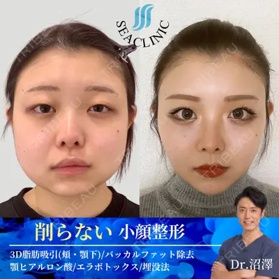 SEA CLINIC（シークリニック） 沼澤 茂医師の症例