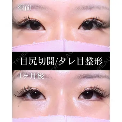HAAB×DREAM BEAUTY CLINIC 大阪梅田院 鈴木 馨斗医師の症例