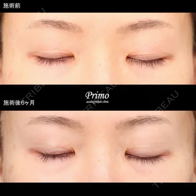 プリモ麻布十番クリニック 大場教弘医師の症例