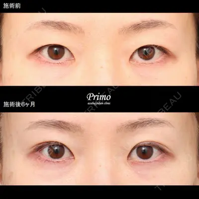 プリモ麻布十番クリニック 大場教弘医師の症例