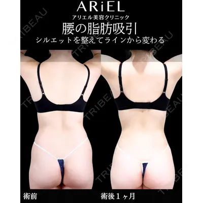 アリエル美容クリニック 横浜院 加藤 敏次医師の症例