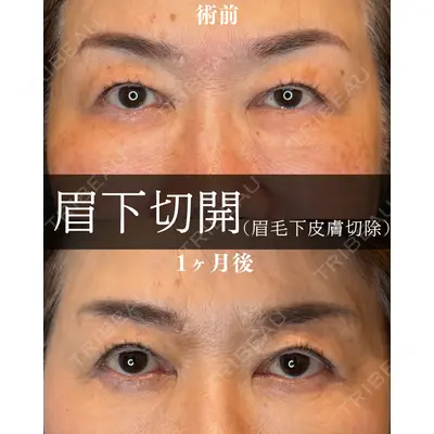渋谷あおぞらクリニック美容外科・美容皮膚科 鶴田 優希医師の症例
