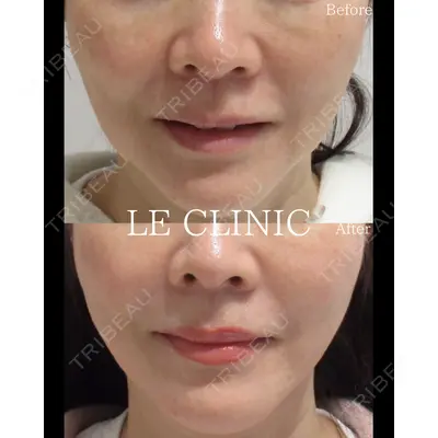 LE CLINICの症例