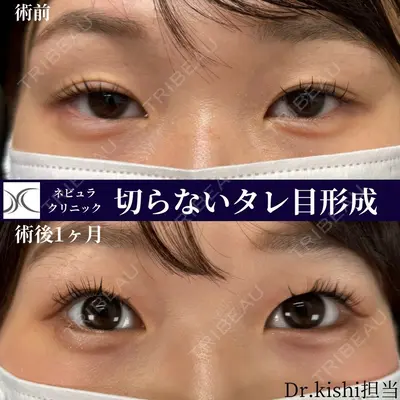 ネビュラクリニック 京都院 岸 大輔医師の症例