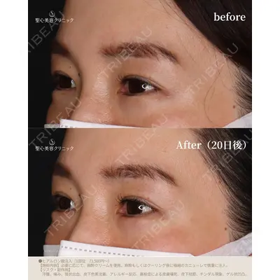聖心美容クリニック 福岡院 權藤 理絵医師の症例