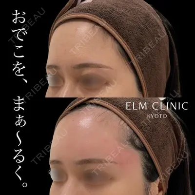 美容皮膚科エルムクリニック 京都院 内山 雄一朗医師の症例