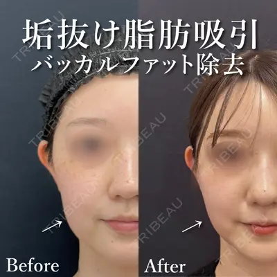 湘南美容クリニック 渋谷院 小草 智之医師の症例
