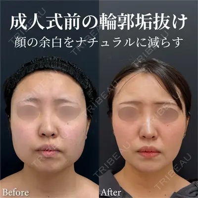湘南美容クリニック 渋谷院 小草 智之医師の症例