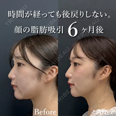湘南美容クリニック 渋谷院 小草 智之医師の症例