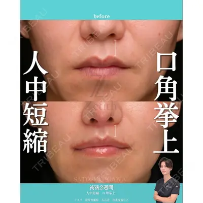 Zetith Beauty Clinic 銀座院 小川 悟史医師の症例