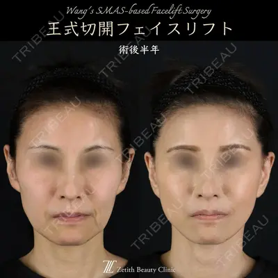 Zetith Beauty Clinic 新宿院 王 蘇医師の症例