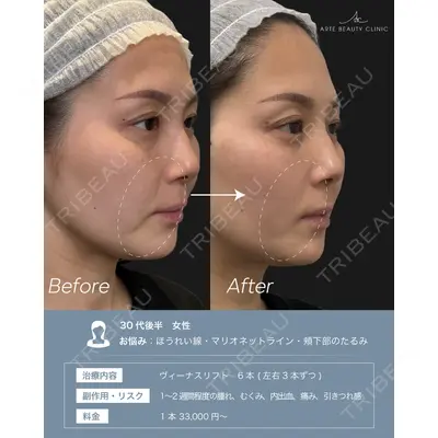ARTE BEAUTY CLINICの症例