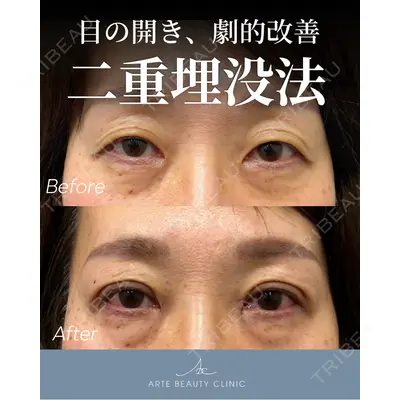 ARTE BEAUTY CLINICの症例