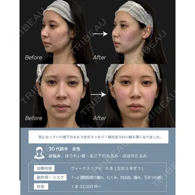 ARTE BEAUTY CLINICの症例