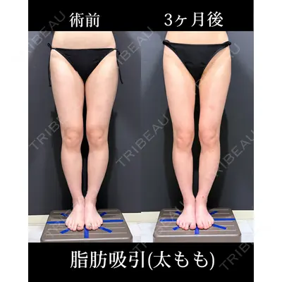 HAAB×DREAM BEAUTY CLINIC 東京本院 吉岡 修一医師の症例
