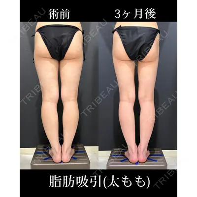 HAAB×DREAM BEAUTY CLINIC 東京本院 吉岡 修一医師の症例