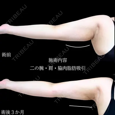 アリエル美容クリニック 横浜院 加藤 敏次医師の症例