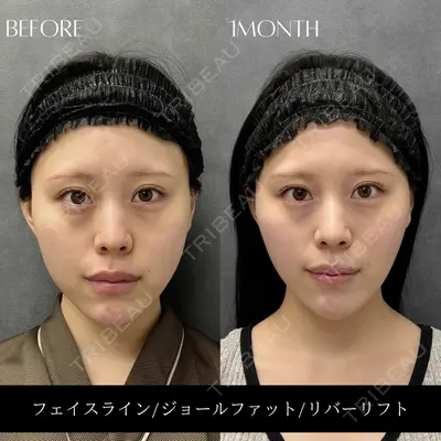 RIVER CLINIC（リバークリニック）大阪院の症例