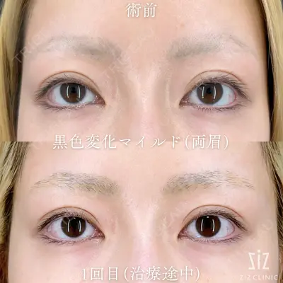 ziz CLINIC 村岡 史子医師の症例