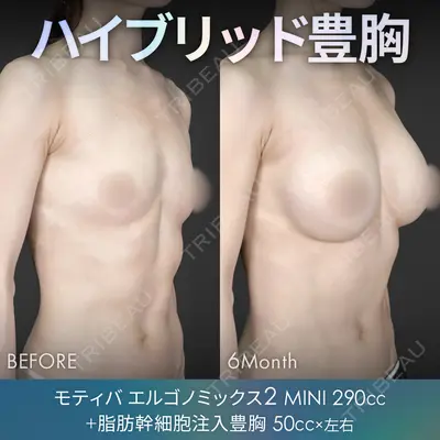 ジョウクリニック 銀座院 重本　譲医師の症例