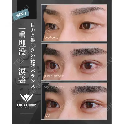 Otus Clinic 【オータスクリニック】 中 徳太郎医師の症例