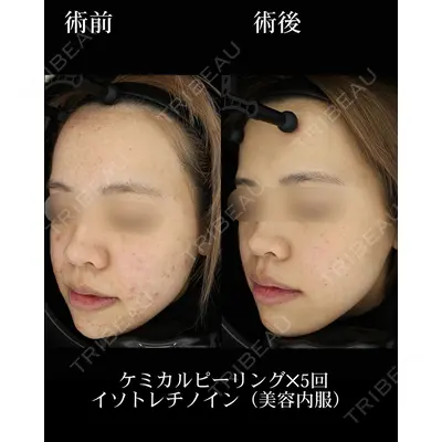 HAAB×DREAM BEAUTY CLINIC 東京本院の症例