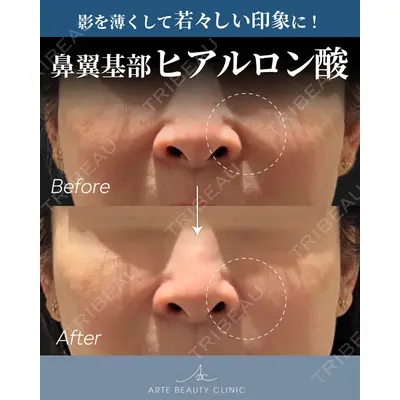 ARTE BEAUTY CLINICの症例