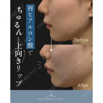 ARTE BEAUTY CLINICの症例
