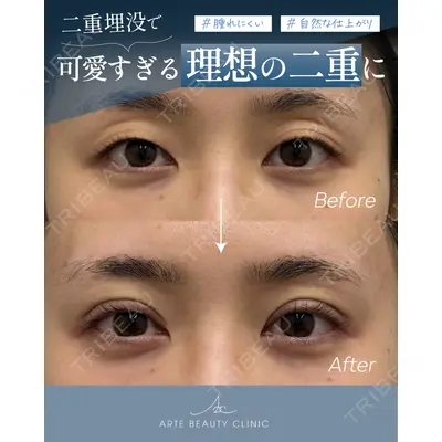 ARTE BEAUTY CLINICの症例