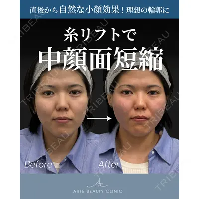 ARTE BEAUTY CLINICの症例