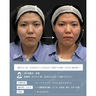 ARTE BEAUTY CLINICの症例