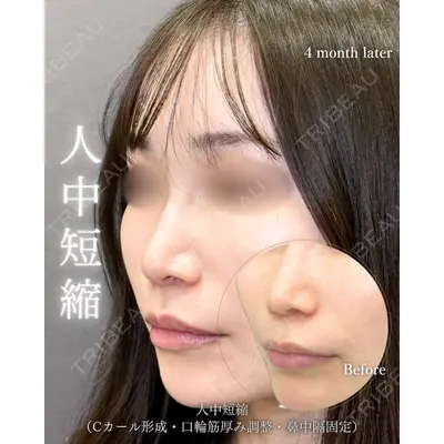 eクリニック 福岡院 伊藤 渉医師の症例