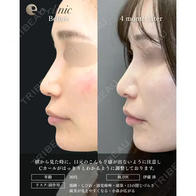 eクリニック 福岡院 伊藤 渉医師の症例