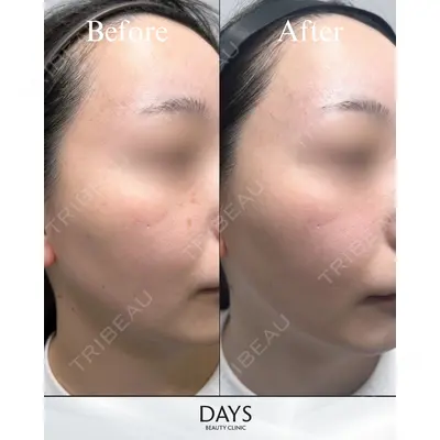 Days Beauty Clinic 新宿院の症例