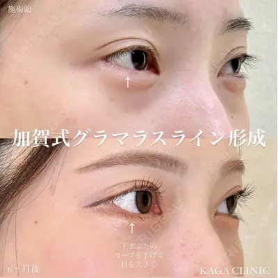 KAGA CLINIC 加賀 裕基医師の症例