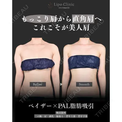 Lipo Clinic omotesando 福田 越医師の症例
