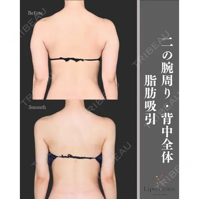 Lipo Clinic omotesando 福田 越医師の症例